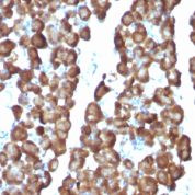 Formalin-fixed, paraffin embedded rat pancreas sections stained with 100 ul anti-Ornithine Decarboxylase-1 (clone ODC1/487) at 1:400. HIER epitope retrieval prior to staining was performed in 10mM Citrate, pH 6.0.